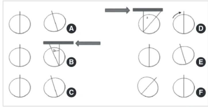 Fig. 5. Maddox rod test.
