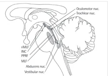 Table 1. Central vs peripheral vestibular nystagmus