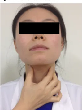 Figure 1. Tongue-holding maneuver.