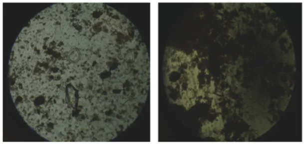 Fig. 7.  Photomicograph  of  microorganisms  observed  samples  between emerging plant roots(×160).