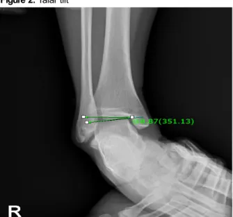 Figure 1. Calcaneal pitch angle