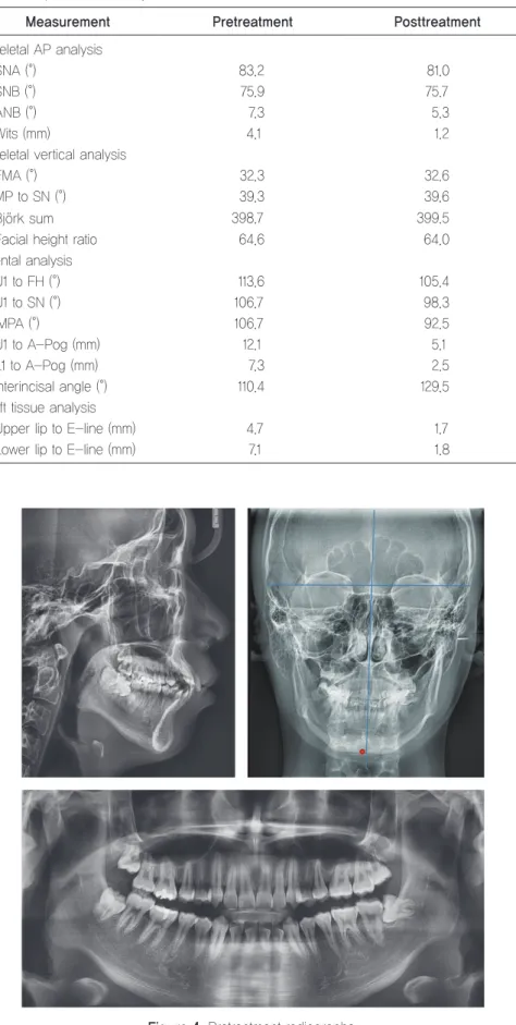 Table 1.	Cephalometric	analysis