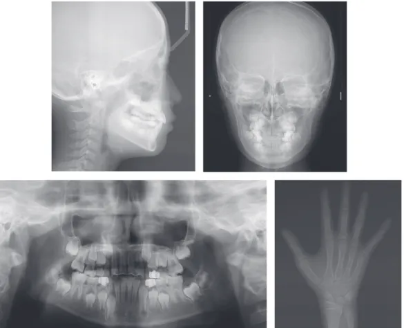 Figure 9.	Posttreatment	radiographs.