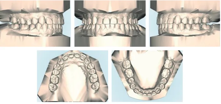 Figure 8.	Posttreatment	dental	casts.