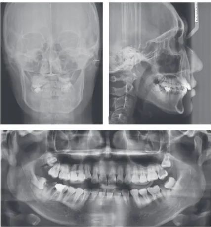 Figure 2.	Pretreatment	cephalometric	and	panoramic	radiographs.