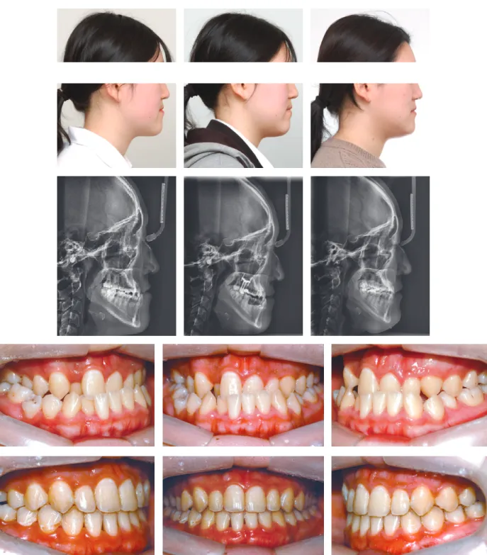 Figure 9. Comparison	before	and	after	treatment.
