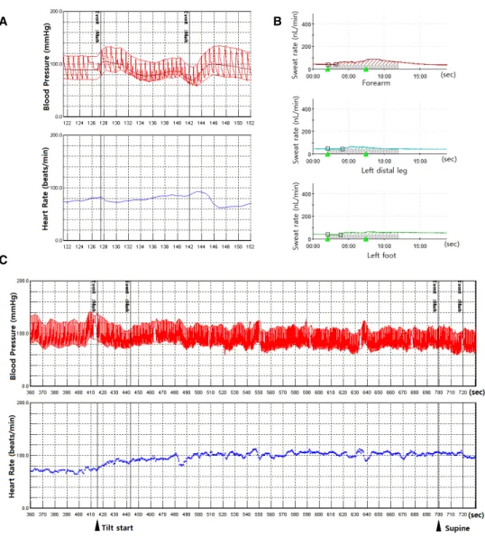 Figure 1. Autonomic function tests. (A) Valsalva maneuver. The valsalva maneuver was performed while maintaining an expiratory pres- pres-sure of 40 mmHg and estimated E:I ratio was normal