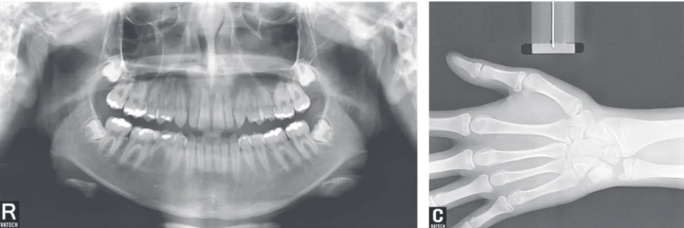 Table 2.	Dental	cast	measurements	