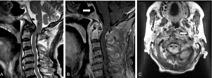 Figure 1. The cervical magnetic resonance imagings (MRIs) of present case. (A) T2 sagittal image