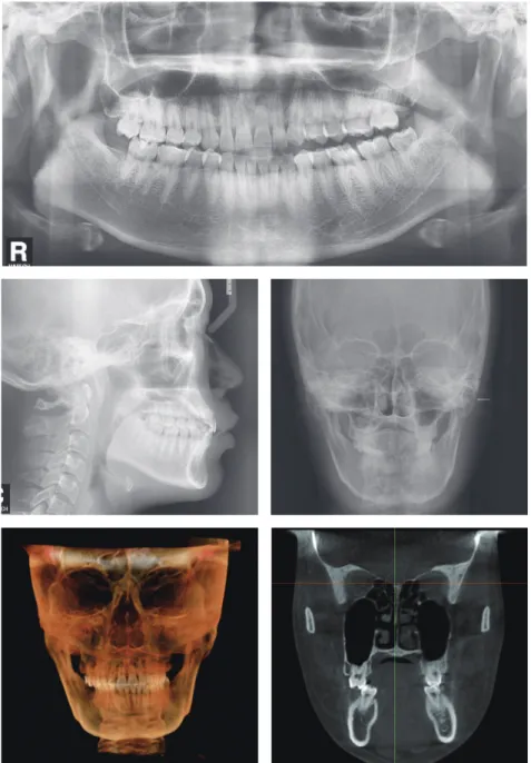Figure 10.	Radiographic	examination	before	treatment.
