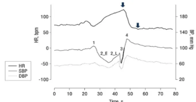 Figure 3. Valsalva maneuver. 1: phase 1, 2_E: early phase 2, 2_L: 