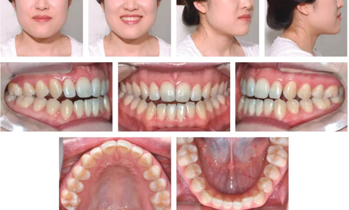 Figure 2.	Pretreatment	panoramic	radiograph.