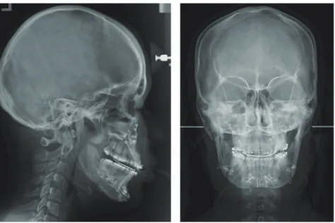 Figure 7.	Postsurgical	cephalometric	radiographs.