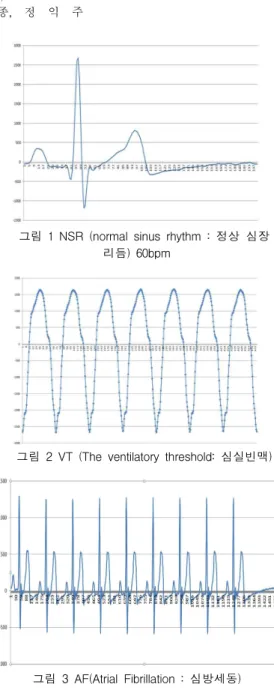 그림 1 NSR (normal sinus rhythm : 정상 심장 리듬) 60bpm