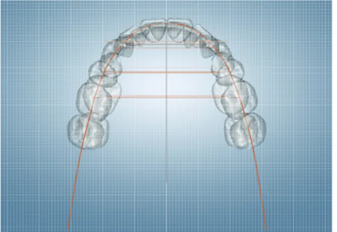 Figure 9.	A	single	line	of	occlusion,	constructed	through	the	 marginal	ridges	or	the	central	developmental	grooves	of	the	 upper	arch	or	through	the	labio-incisal	and	bucco-occlusal	 contact	of	the	lower	arch,	is	applied	for	automatic	occlusion	 setup.