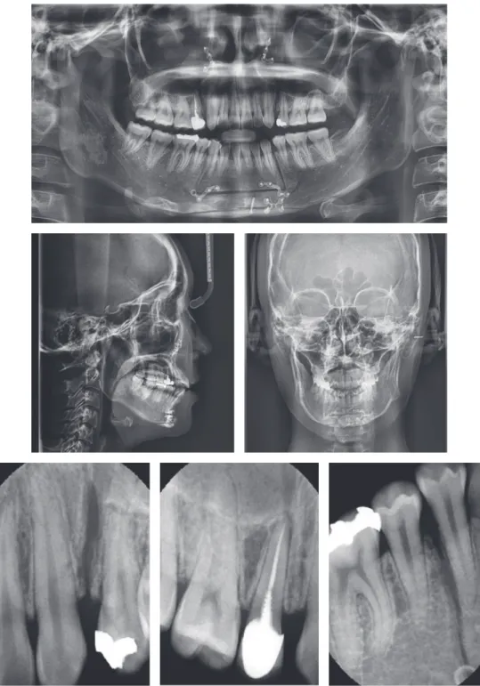 Figure 3.	Pretreatment	radiographs.