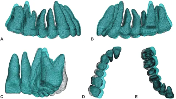 Figure 8.	Model	2.	Superimposition	of	the	original	(white	mesh)	and	deformed	model	(color).	A, B,	Sagittal	view	(external	and	lingual).	