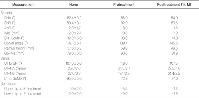 Table 1.	Results	of	the	cephalometric	analyses	before	and	after	treatment