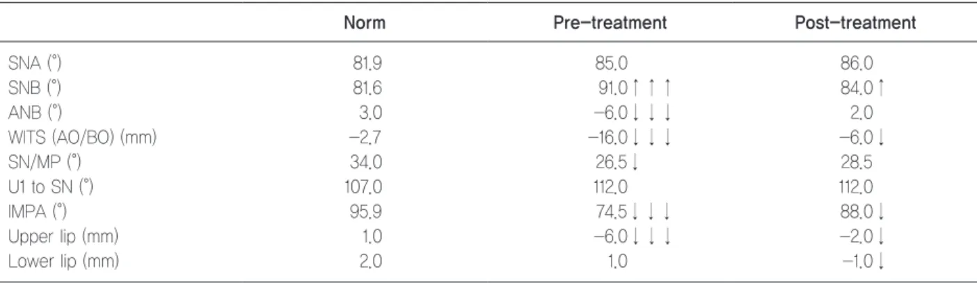 Table 1.	Measurements	of	the	lateral	cephalogram	before	and	after	treatment