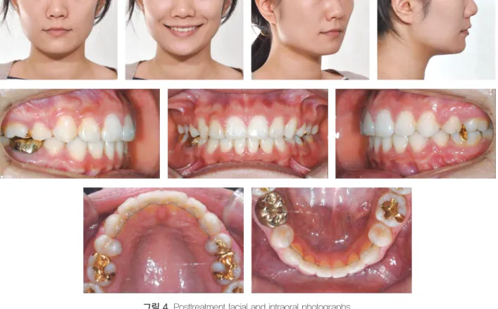 그림 5. Posttreatment lateral and frontal cephalograms and panoramic radiograph.