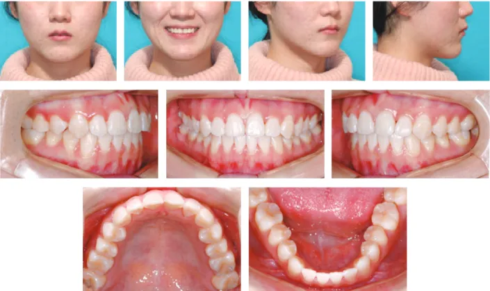 그림 6. Postreatment panoramic and lateral cephalometric radiographs.