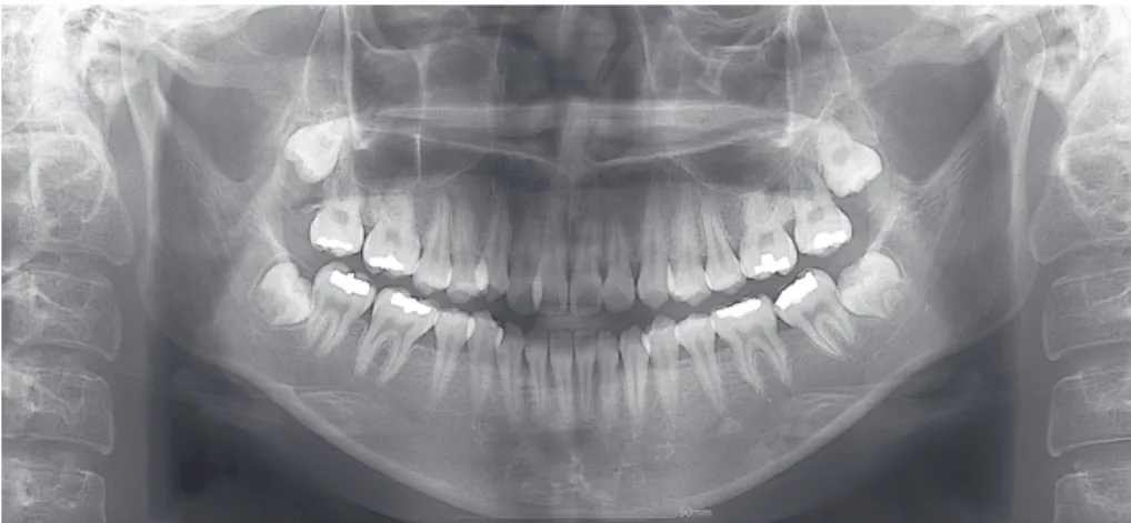그림 9. Panoramic radiographs.