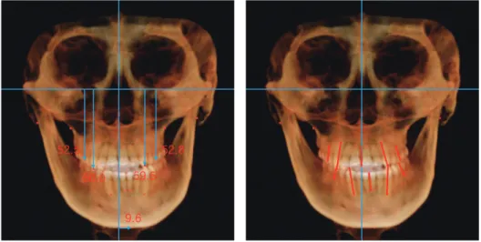 그림 3.  치료 전 CBCT 분석 