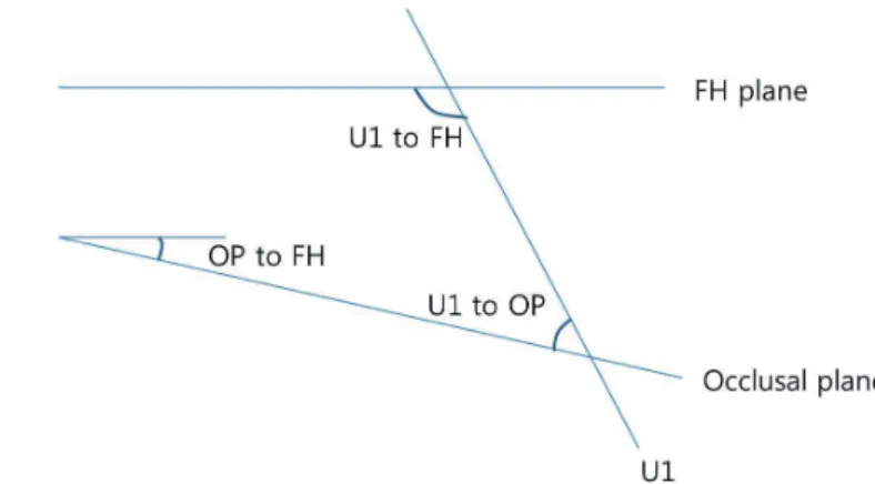 그림 1.  U1 to FH, U1 to OP, OP to FH 각도 사이의 상호 관계