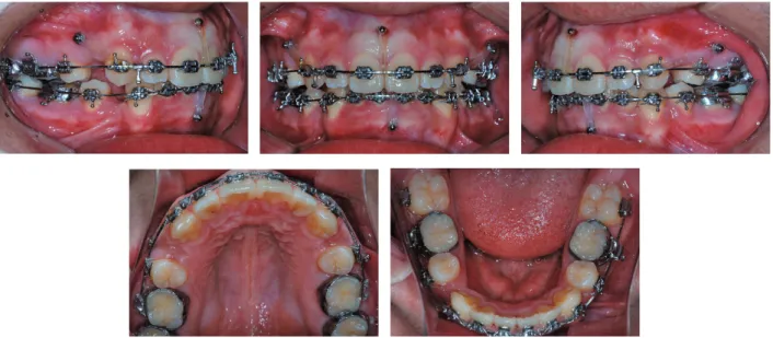 그림 8.  치료 종료 시 구외 사진
