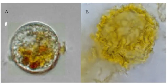 Fig.  2.  Destruction  of  C.  polykrikoides  with  the  addition  of  hydrogen    peroxide  (A:  cell-fixed  type,    B:  lysed  and  destructed  type)