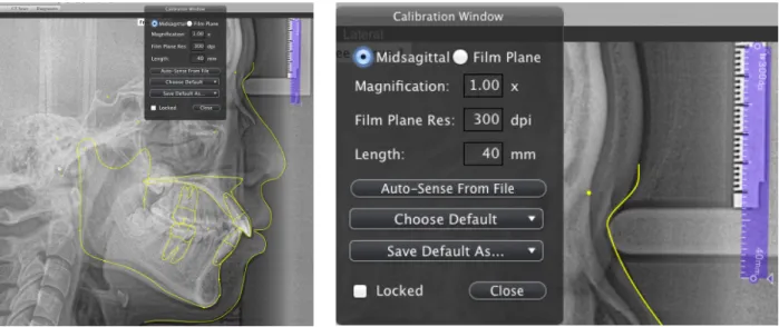 그림 9.  Quick Ceph Studio에서 제공하는 캘리브레이션 