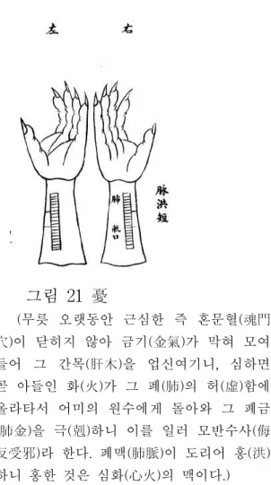 그림 20 思 (무릇 오랫동안 생각한 즉 의사혈(意舍 穴) 편안하지 않아 위로 기가 올라가 응결 되어 그 신수(腎水)를 업신여기니, 심하면 곧 아들인 목(木)이 그 비토(脾土)가 허함에 올라타서 어미의 원수에게 돌아와 그 비토 (脾土)를 극하니 이를 일러 모반수사(侮反受 邪)라 한다