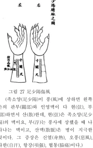 그림 26 足陽明傷濕 (족양명(足陽明)이 습(濕)에 상하면 오른 쪽 손의 관부(關部)와 인영이 다 색(濇), 세 (細)하면서 장(長)하다. 색(濇)은 족양명의 맥이요, 장(長)은 병이 침습하는 것이다