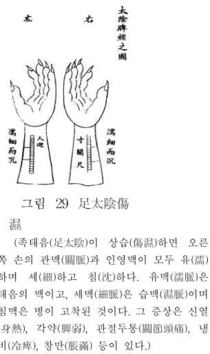 그림 28 手少陽傷 暑 (수소양(手少陽)이 상서(傷暑)하면 왼쪽 손의 척맥(尺脈)과 인영맥이 모두 홍(洪)하 며 허(虛)하고 삭(數)하다. 홍맥(洪脈)은 수 소양의 맥이고, 허맥(虛脈)은 상서의 맥이며 삭맥(數脈)은 병의 증세가 심해진 것이다