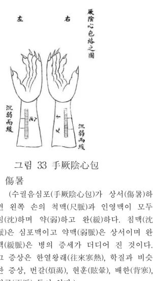 그림 32 足少陽傷 風 (족소양(足少陽)이 풍(風)에 상하면 왼쪽 손의 관부(關部)와 인영맥이 다 현(弦), 부 (部)하면서 산(散)한데, 현(弦)은 족소양(足少 陽)의 맥이요, 부(浮)는 풍사에 상했을 때 나 타나는 맥이고, 산맥(散脈)은 병이 지극한 것이다