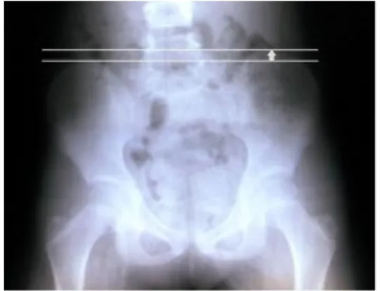 Fig.  2.  Result  of  foot  balance.