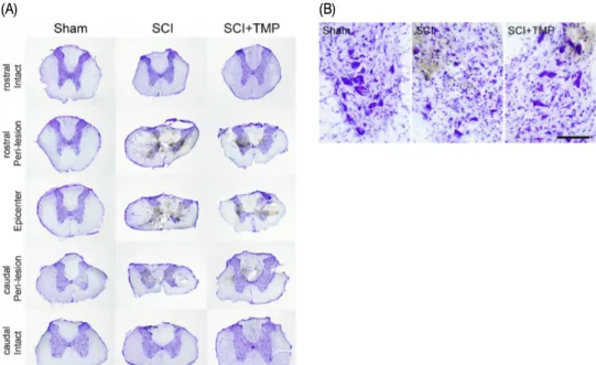 Fig.  3.  Representative  photographs  showing  spinal  tissue  damage  by  compression  in  SCI  rat.