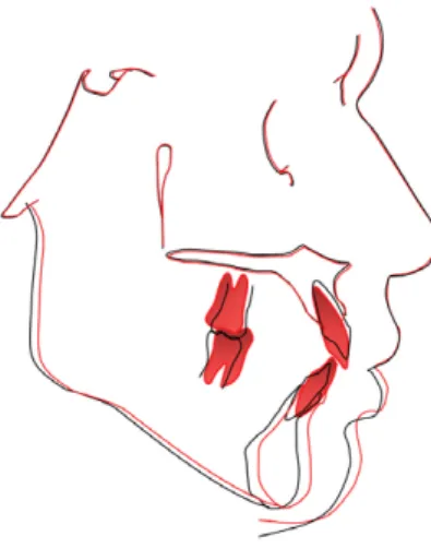 그림 9. 초진 시 안모 사진
