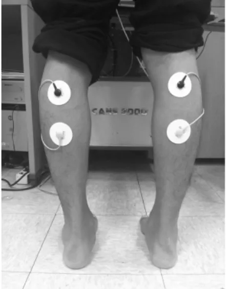 Fig.  2.  MPT  were  measured  on  BL57,  2.5  cm  above  BL57  and  2.5  cm  below  BL57