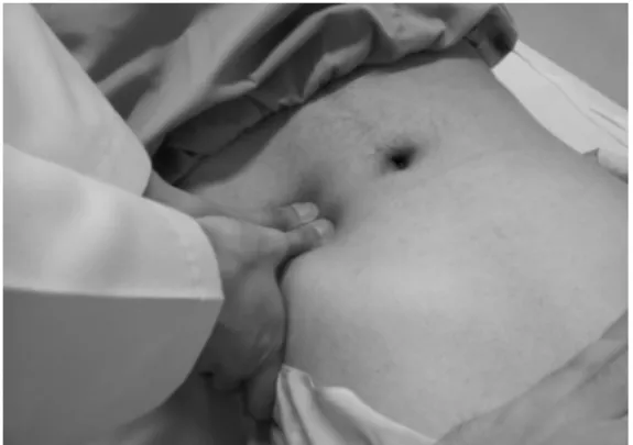 Fig.  1.  Acupuncture  on  iliopsoas  muscle.