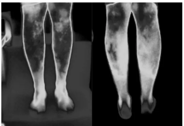 Fig.  1.  Both  feet  view(12.10.5).