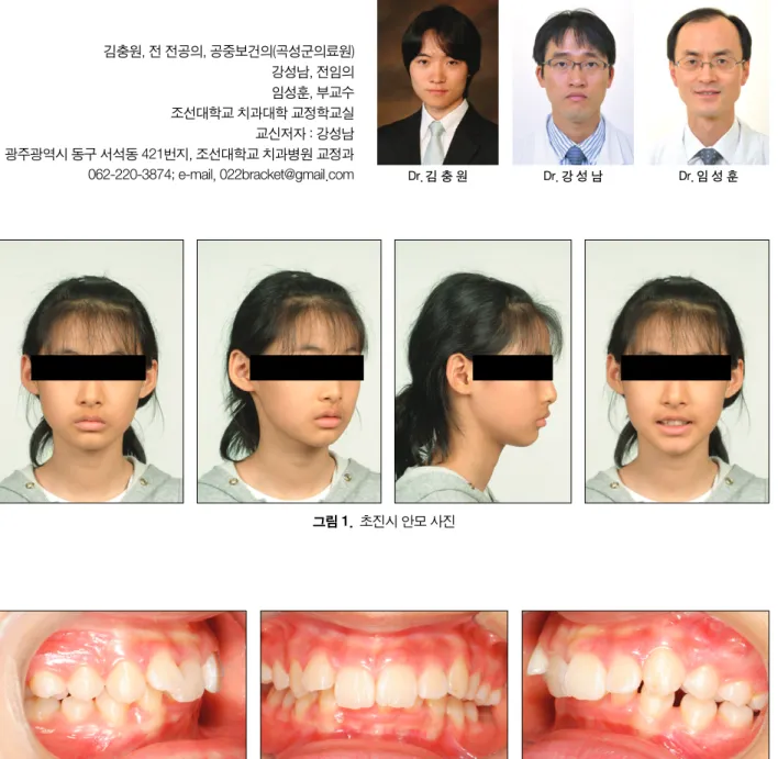 그림 2. 초진시 구강내 사진.그림 1. 초진시 안모 사진 Dr. 강 성 남Dr. 김 충 원 Dr. 임 성 훈김충원, 전 전공의, 공중보건의(곡성군의료원)강성남, 전임의임성훈, 부교수조선대학교 치과대학 교정학교실교신저자 : 강성남광주광역시 동구 서석동 421번지, 조선대학교 치과병원 교정과062-220-3874; e-mail, 022bracket@gmail.com 