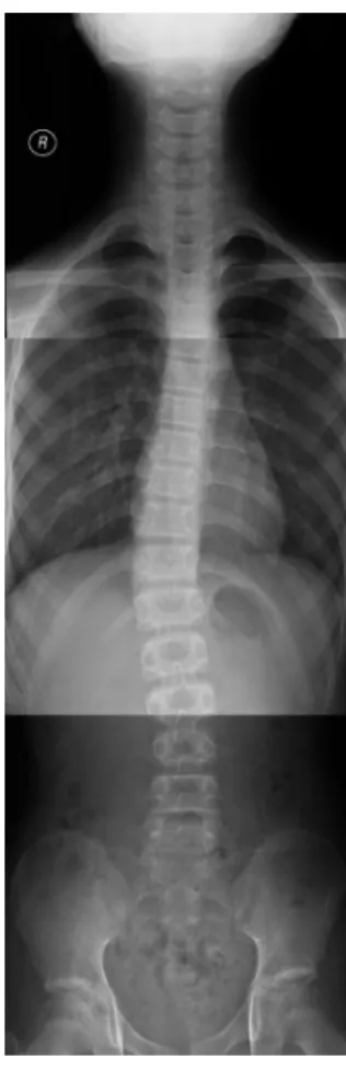 Fig.  7.  Full  spine  AP  (2014.  6.  7).