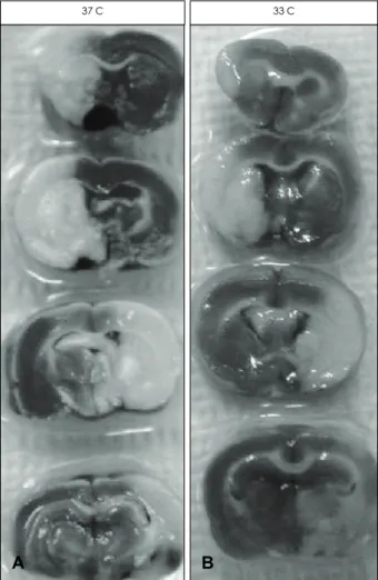 Figure 1. Hypothermia protects the brain against experimental ischemic stroke. Infarct size was decreased in hypothermic brain when the sections were stained with 2, 3, 5 - triphenyl tetrazolium chloride  (TTC)