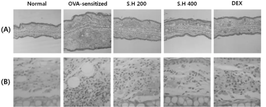 Fig.  2.  The effect of S.H on his- his-tological  features  of  ear  skin  in  OVA-sensitized  mice