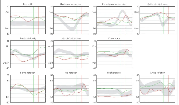 Figure 1. Kinematic data before gait training with RAS in TBI. RAS: rhythmic auditory stimulation, TBI: traumatic brain injury.