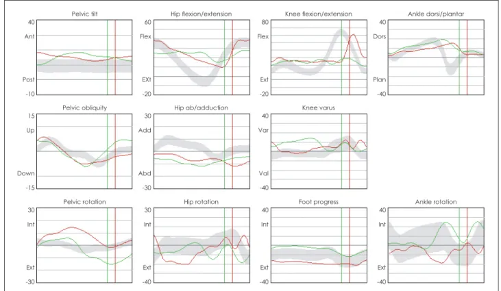 Figure 2. Kinematic data after gait training with RAS in TBI. RAS: rhythmic auditory stimulation, TBI: traumatic brain injury.