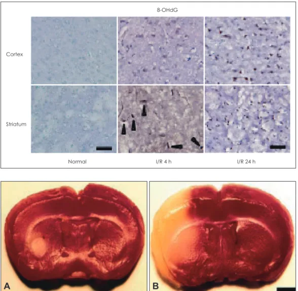 Figure 3. To investigate oxidative DNA  damage after ischemia/reperfusion in  brain, 8-OHdG in the cortex and striatum  were quantitated
