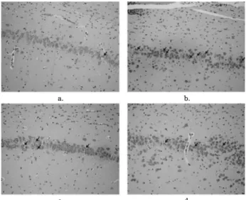 Fig.  8.  The  immunohistochemical  finding  on  Tau  expression  on  hippocampus  (×200,  21  days,;  (a)  groupI,  (b)  group  II,  (c)  group  III,  (d)  group  IV).