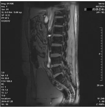 Fig.  1.  L4-5  Axial  Image  of  L-spine  MRI. Fig.  3.  Sagittal  Image  of  L-spine  MRI.